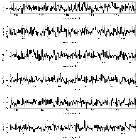 Counts Spectrum (3)_RX J0720.4-3125_obsid_10861