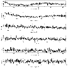 Counts Spectrum (2)_Mrk 421_obsid_10665