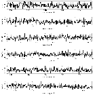 Counts Spectrum (3)_Mrk 421_obsid_10665