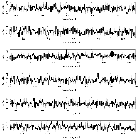 Counts Spectrum (3)_Mrk 421_obsid_10667