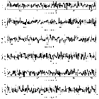 Counts Spectrum (2)_RX J0806.3+1527(HM Cnc)_obsid_11028