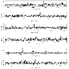Counts Spectrum (3)_procyon_obsid_10994
