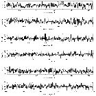 Counts Spectrum (2)_RX J0720.4-3125_obsid_11820