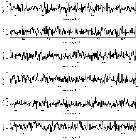 Counts Spectrum (3)_Mrk 421_obsid_13104