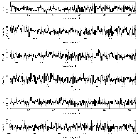 Counts Spectrum (2)_NGC 4593_obsid_12154