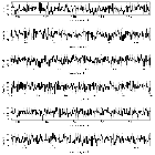 Counts Spectrum (3)_NGC 4593_obsid_12154