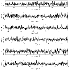 Counts Spectrum (2)_NGC 4593_obsid_13240