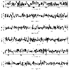 Counts Spectrum (3)_NGC 4593_obsid_13240