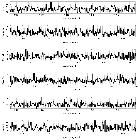 Counts Spectrum (3)_Nova LMC 2012_obsid_14426