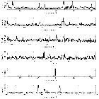 Counts Spectrum (2)_beta Ceti_obsid_2547