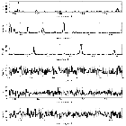Counts Spectrum (3)_beta Ceti_obsid_2547