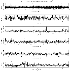 Counts Spectrum (1)_61 Cyg A_obsid_13651