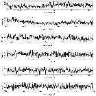 Counts Spectrum (2)_RX J1856.5-3754 _obsid_15293