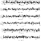 Counts Spectrum (3)_RX J1856.5-3754 _obsid_15293