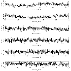 Counts Spectrum (2)_4U 1543-62_obsid_13283