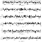 Counts Spectrum (3)_4U 1543-62_obsid_13282