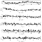 Counts Spectrum (2)_Mrk 421_obsid_15481