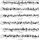 Counts Spectrum (3)_Mrk 421_obsid_15481