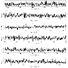 Counts Spectrum (3)_Mrk 421_obsid_15479