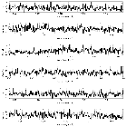 Counts Spectrum (3)_Mrk 421_obsid_15483