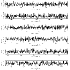 Counts Spectrum (3)_RX J1856.5-3754 _obsid_14418