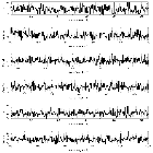 Counts Spectrum (2)_RX J0720.4-3125_obsid_13294