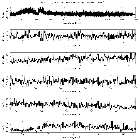 Counts Spectrum (1)_RX J0720.4-3125_obsid_13294