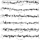 Counts Spectrum (2)_Mrk 421_obsid_16428