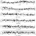 Counts Spectrum (2)_Mrk 421_obsid_16426