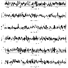 Counts Spectrum (3)_Mrk 421_obsid_16430