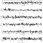 Counts Spectrum (2)_4U 0513-40 (in NGC 1851)_obsid_14457