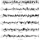 Counts Spectrum (3)_4U 0513-40 (in NGC 1851)_obsid_14457
