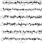Counts Spectrum (2)_4U 0513-40 (in NGC 1851)_obsid_14456