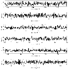 Counts Spectrum (3)_4U 0513-40 (in NGC 1851)_obsid_14456