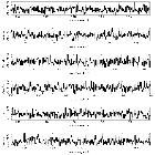 Counts Spectrum (3)_NGC 5548_obsid_16314