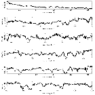 Counts Spectrum (2)_SWIFT J1753.5-0127_obsid_15743