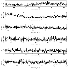 Counts Spectrum (2)_ASASSN-14li_obsid_17567