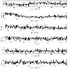Counts Spectrum (2)_ASASSN-14li_obsid_17566