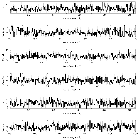 Counts Spectrum (2)_V745 Sco_obsid_15738