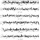 Counts Spectrum (3)_V745 Sco_obsid_15738