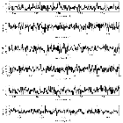 Counts Spectrum (3)_SMC 3_obsid_16313