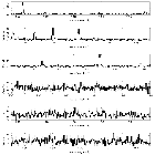 Counts Spectrum (3)_Capella_obsid_1009
