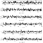 Counts Spectrum (3)_4U 1626-67_obsid_15765