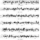 Counts Spectrum (3)_4U 1626-67_obsid_16636
