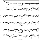 Counts Spectrum (2)_NOVA Sgr 2015 b_obsid_16690