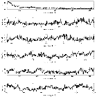 Counts Spectrum (2)_NOVA Sgr 2015 b_obsid_16691
