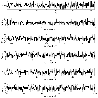 Counts Spectrum (2)_RT Cru_obsid_18710