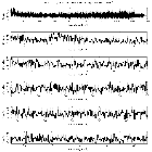 Counts Spectrum (1)_RT Cru_obsid_18710