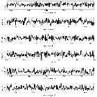 Counts Spectrum (3)_RT Cru_obsid_16688