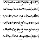 Counts Spectrum (2)_SN 1987A_obsid_18808